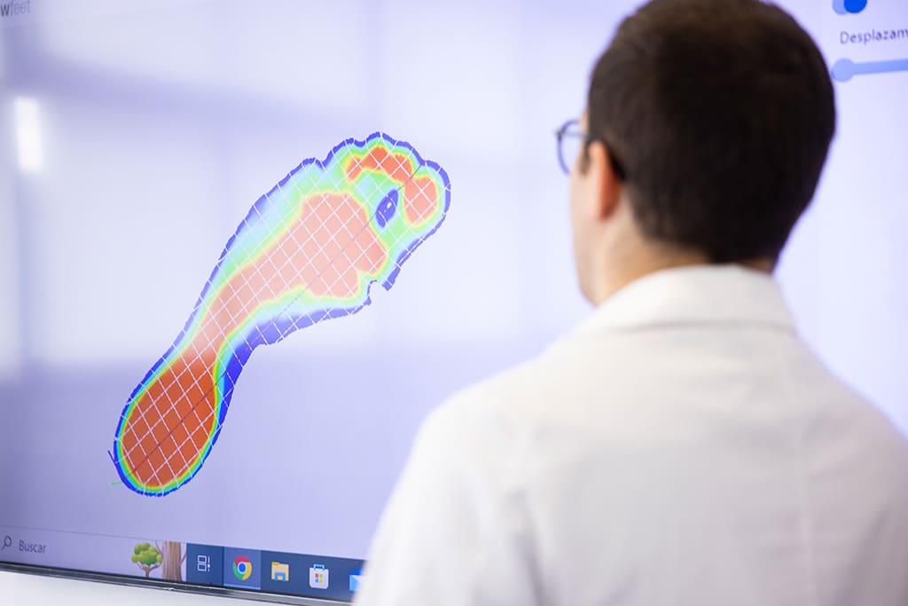 estudio biomecanico pisada